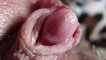 Clitoris